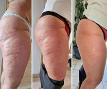 Afbeelding in Gallery-weergave laden, Anti-Cellulite Gel + Peeling