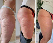 Anti-Cellulite Gel + Peeling